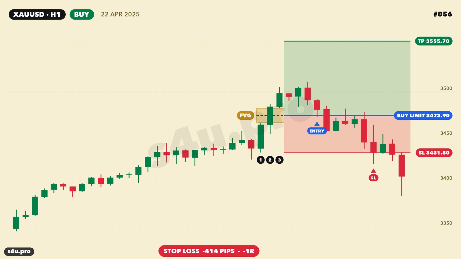 Losing FVG gold trade — stop loss