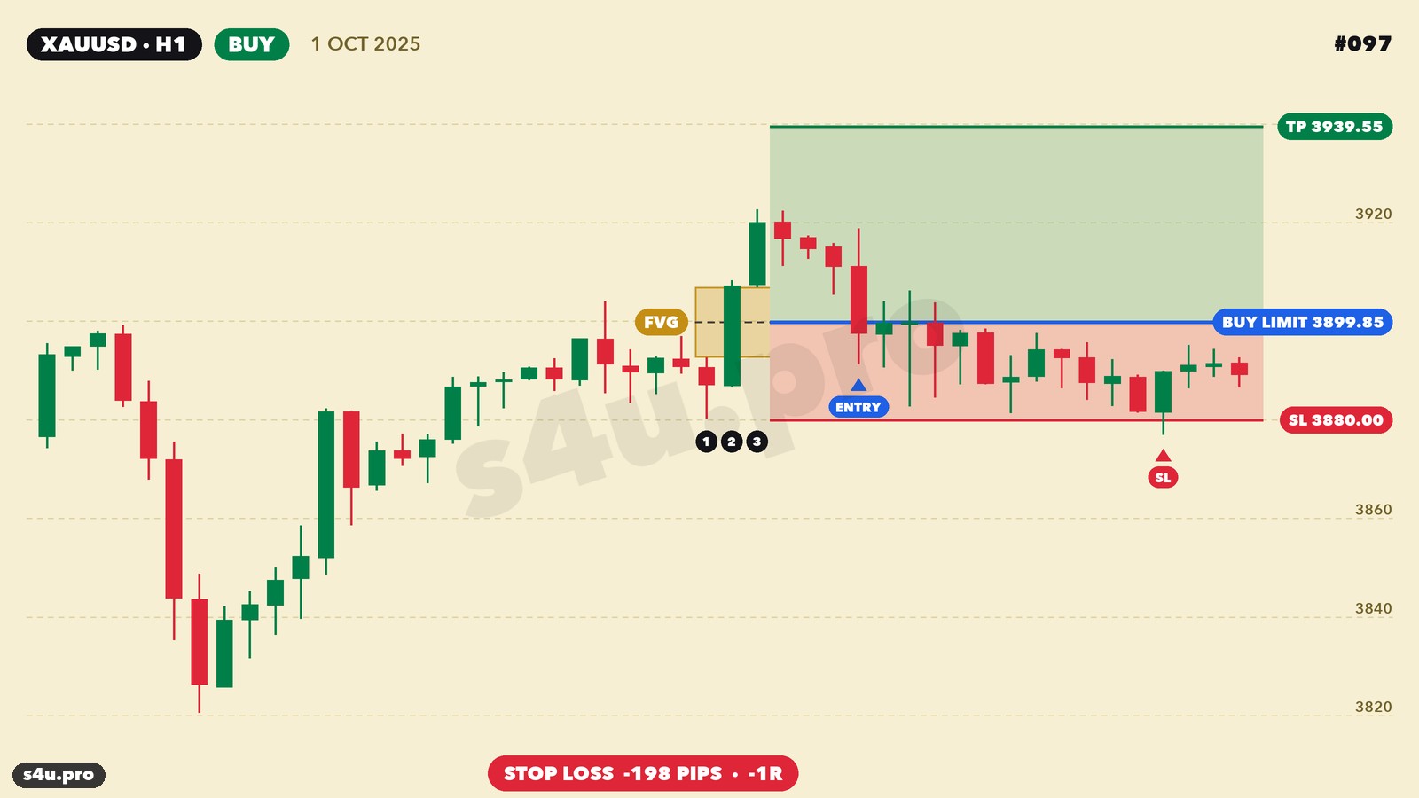 Losing FVG gold trade — stop loss, October 2025