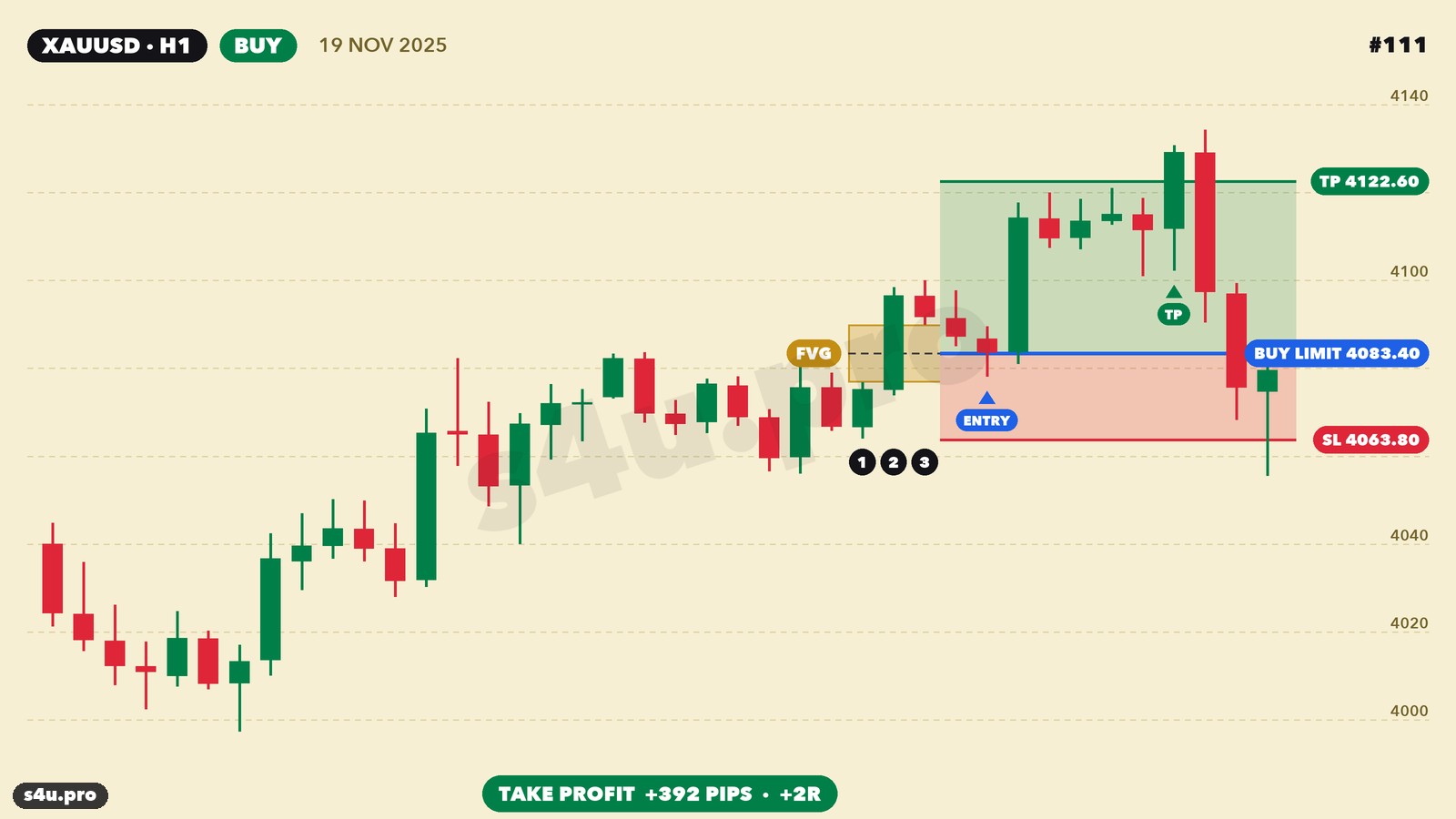 FVG XAUUSD example — buy, November 2025