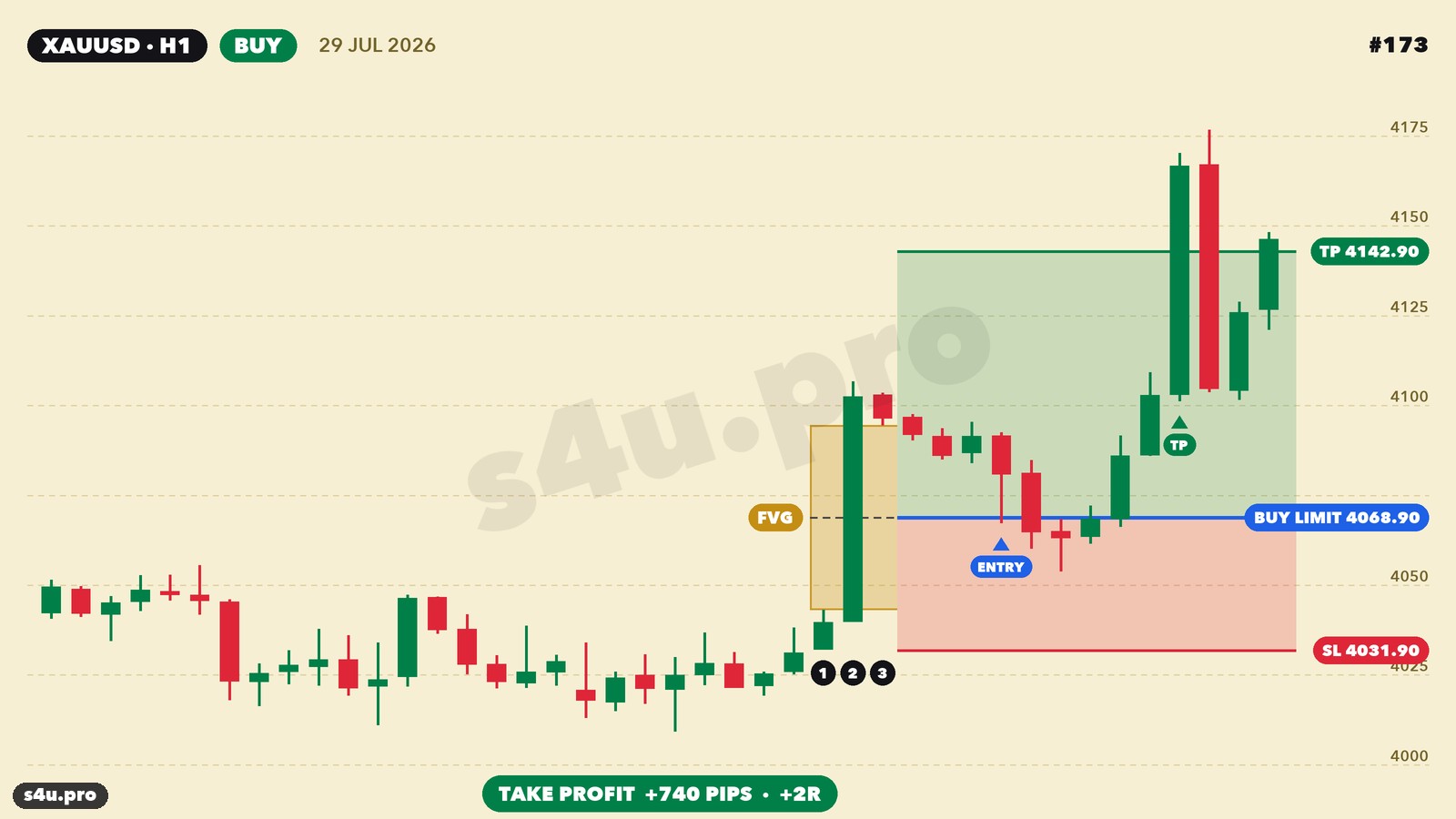 FVG XAUUSD example — buy, July 2026